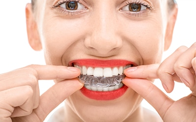 The Importance Of Dental Retainers - Kuhni Orthodontics